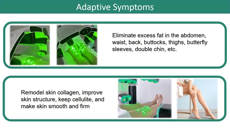 Fat Removal Body Slimming Device Emerald Laser Green Light 532nm Non Invasive