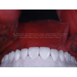 China Zirconia Ceramic Veneer Natural White factory