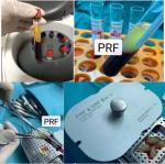 Dental Centrifuge Machine Blood Collection 16×100 Tube