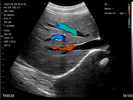 USB Convex Ultrasound Transducer Wireless Convex Array Ultrasound Probe for OB/GYN Lung Urology Application
