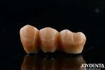 High Flexural Strength Multilayer Full Zirconia Dental Solution Full Arch