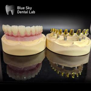 China Screw retained MUA abutment Implant Cases Zirconia crowns Multilayer pink porcelain with Easy repair factory