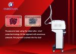 Yag Laser Q - Switch IPL RF Beauty Equipment For Tattoo And Birth Mark Removal