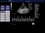 GH-L5 Portable Ultrasound Machine 4d Diagnostic Ultrasound Pregnancy Machine