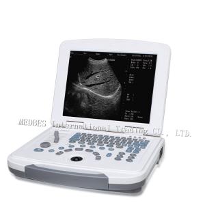 China Clinic 80 elements Laptop Ultrasound Scanner B580 with Battery factory