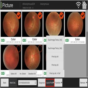 China Manual Digital Fundus Camera Ophthalmology Coherence Tomography factory
