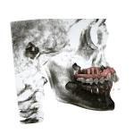 Customized Rubber Fixed Orthodontic Appliances Easy Maintain