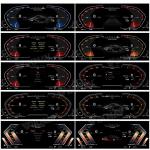 VIKNAV 12.3" Instrument Cluster for BMW 5 Series E60/E61/E63/E64 2004-2009
