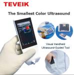 Wireless Ultrasound Tranducer Android Color Doppler Ultrasound Probe Wireless
