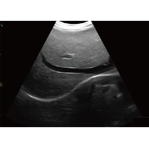 Notebook Ultrasound Scanner Easy to Carry Laptop Ultrasound Scanner With Touch Screen Control Panel