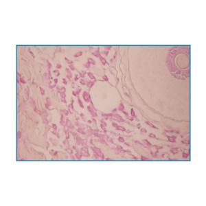 Mast Cell Stain (Aldehyde fuchsin-OG6 staining method)