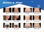 CE Cryolipolysis Slimming Machine For Fat Freeze , Non-Invasive