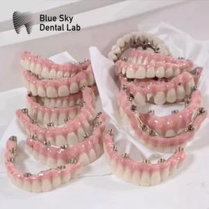 China Blue Sky Implant Cases With Malo Frame Bridge Pure Titanium factory