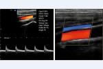 Mobile Medical Ultrasound Machine 3D Color Doppler Ultrasound