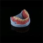 Removable Smile Full Acrylic Complete Denture Customizable
