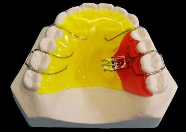 Three Direction Removable Orthodontic Appliances For Customer Requirements At