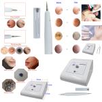 Face Pore Cleaner Skin Tag Removal Machine 110V 220V 12W CE Certified