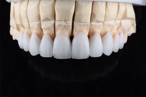 China Crack Resistance Zirconia Multilayer Ceramic Ultimate Solution For Industrial Efficiency factory