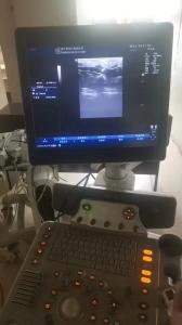 China GE original imaging ultrasound machine Logiq P6 factory
