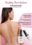 Exfoliating Serum Skin Peeling Solution Acne Remover Skin Care Skin Peeling 30ml