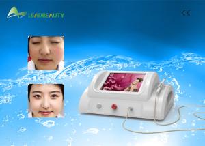 China Smart Mini 150W Spider Vein Removal Machine High Frequency 30MHz RBS factory