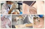Fractional CO2 Laser Scar Therapy Removal Skin Rejuvenation Resurfacing Laser