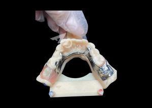 China Easy Maintenance Cast Partial Dentures for Superior Strength and Aesthetic Appeal factory