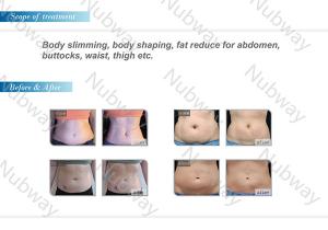 China Most and Best popular HIFUSHAPE Slimming Machine in the world factory