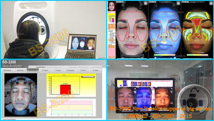 8800 Lux Skin Analysis Machine / Hair And Skin Analyzer For Dermal Skin Analysis