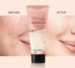 Face Wash Facial Cleanser Whitening Face Wash With Rice Extract for Oily Dry