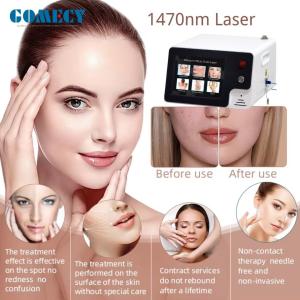China Laser 1470nm EVLT Varicose Removal Red Blood Veins Reducing Laser Machine factory