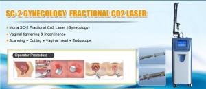 China Factory prices Quality frational laser co2 for vaginal tighten factory