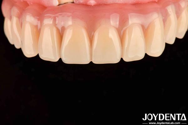 Dental Treatment High Elasticity Acrylic False Teeth Finish For Tooth Arrangemen