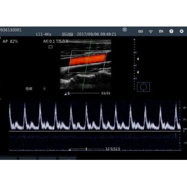 Compact Lightweight Hand Held Doppler With Max 8 Hours Continuous Working