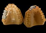 Moderate Translucency Porcelain Fused To Metal PFM Crown , PFM Ceramic Crown