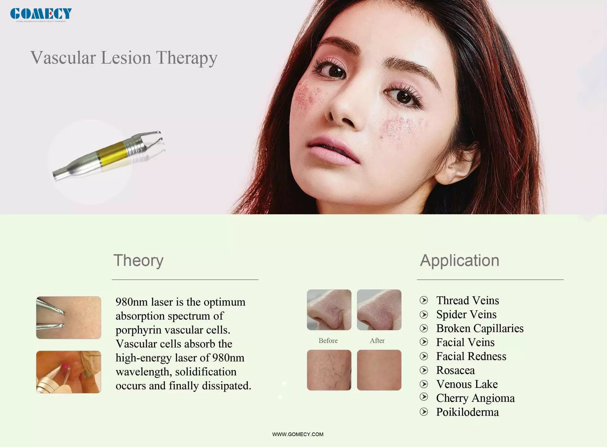 5 In 1 1470nm Laser 980nm Laser Vascular Removal Machine