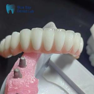 China Regular Zirconia Implant Case Personalized Dental Implant Case factory