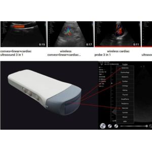 IOS Android Windows Handheld Portable Ultrasound Device Convex Linear Cardiac 3