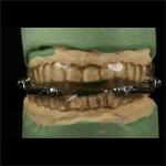 Flexible Non Snoring Mouthpiece Devices With Adjustable Straps