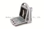 Top Sale Laptop Ophthalmic AB Mode Ultrasound Scanner Equipment