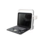 Silver 4D Colour Doppler Ultrasound High Resolution For Obstetrics