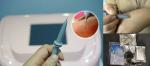 Small High Frequency Skin Tag Removal Laser Machine With Fan Cooling System