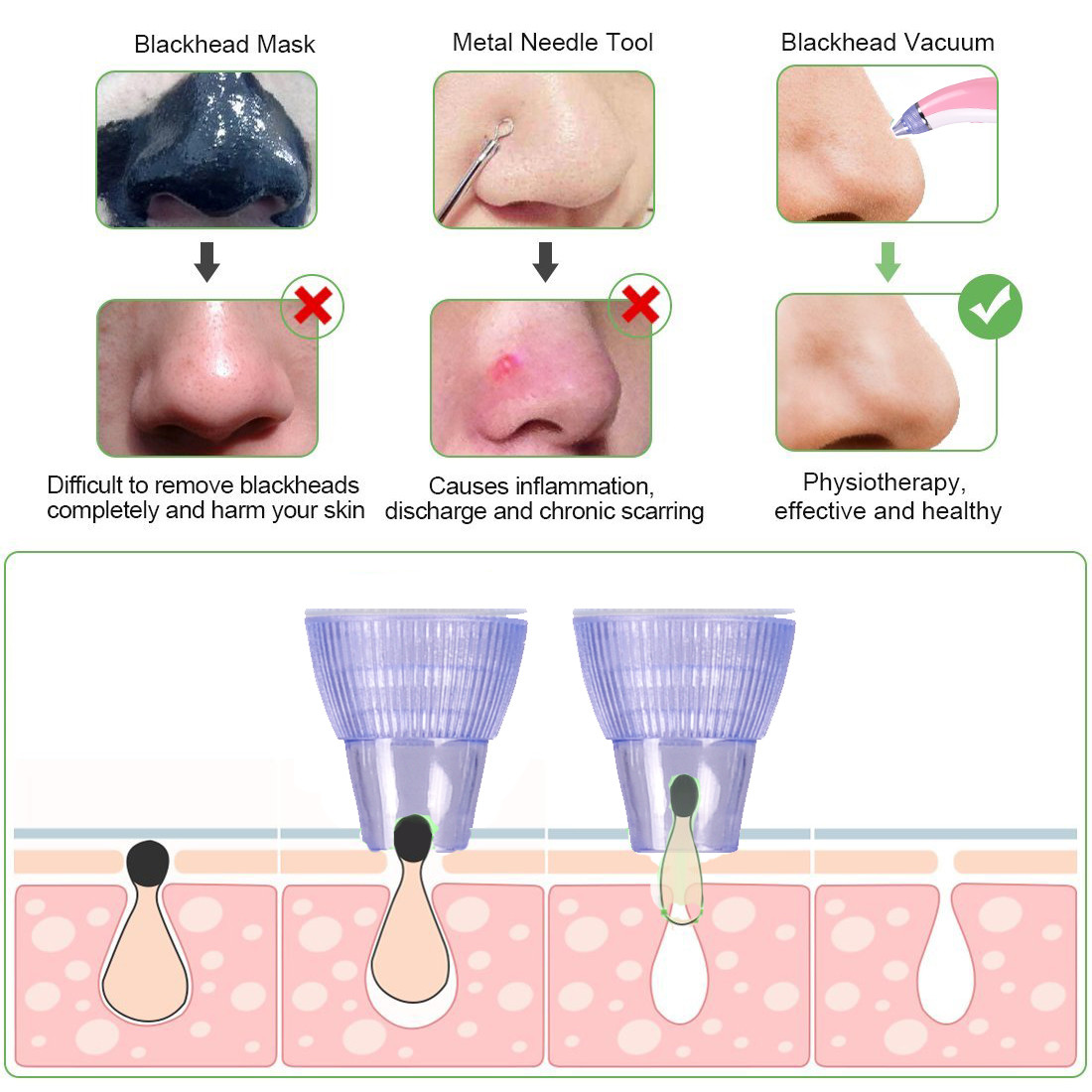 Home Use Blackhead Remover Machine , 4 In 1 Blackhead Vacuum Gun