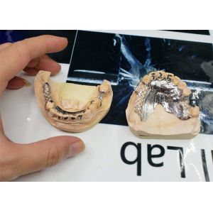 High Accuracy CAD-CAM Fixed Removable Bridge Digitization Design