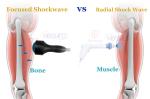 Electromagnetic Focused Shockwave Therapy Focus Shock Wave Fisioterapia