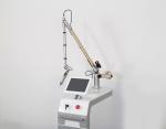 Hot Sale Q switch nd yag laser tattoo removal,nd yag laser tattoo removal