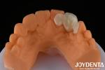 Metallic Material Precise Coloring EMax Maryland With Ideal Color Matching