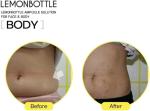 Lemon Bottle Solution Lipolysis weight loss 10ml X 5 fat loss lemonbottle