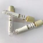 Coggulation Double Wall Blood Test Tube Plasma vacuum blood colletion tube Tubes