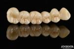Natural Looking Multilayer Full Zirconia For Dental Restorations Ultra